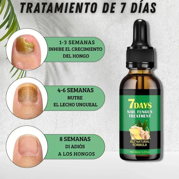 Aceite Esencial para Uñas Saludables