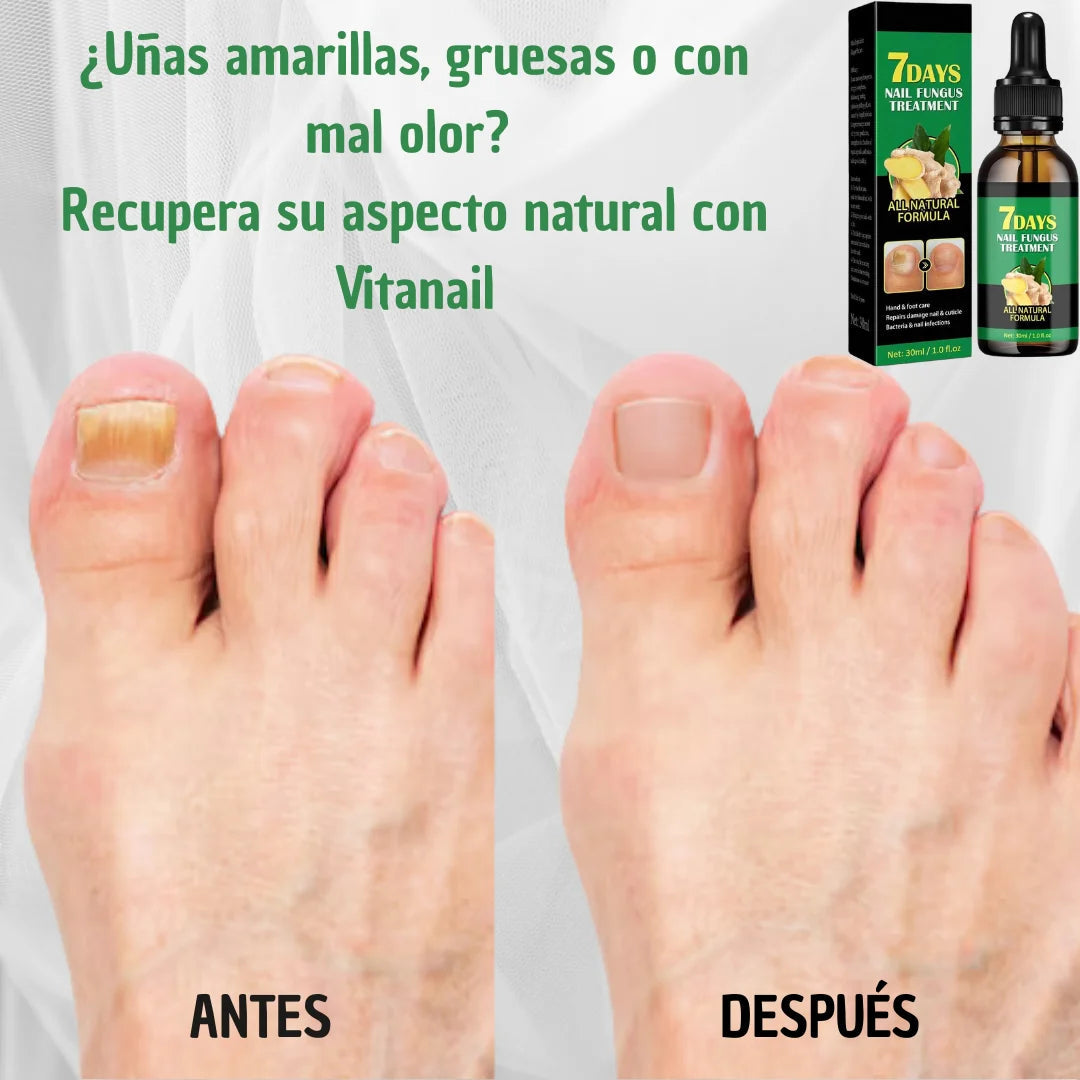 Aceite Esencial para Uñas Saludables